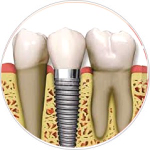 Best Orthodontist in Delhi | Dr. M Jetley 